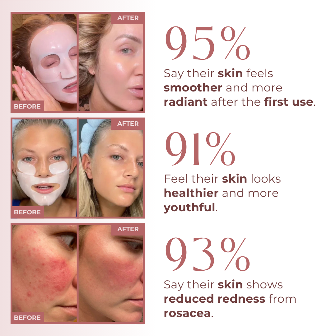 Skinova Overnight Renewal Mask