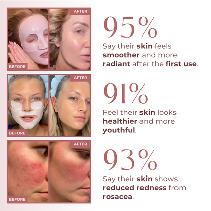 Skinova Overnight Renewal Mask