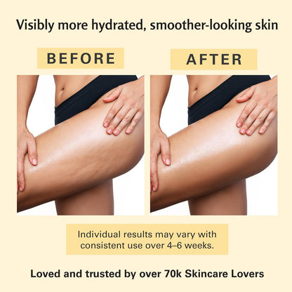 Skinova Anti-Cellulite Massage Oil