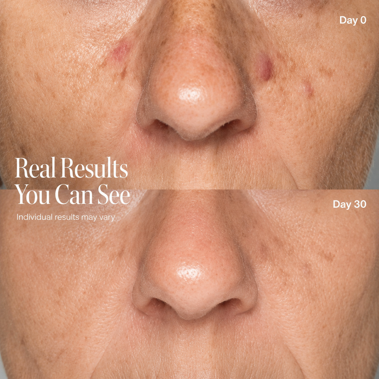 SKINOVA Red Light Neck & Face Mask