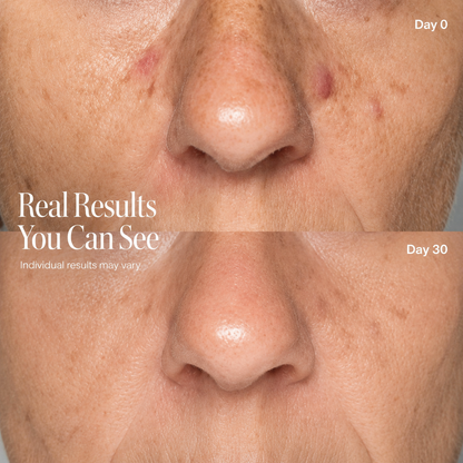 SKINOVA Red Light Neck & Face Mask